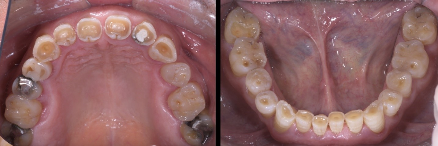 garrison-roberto-turrini