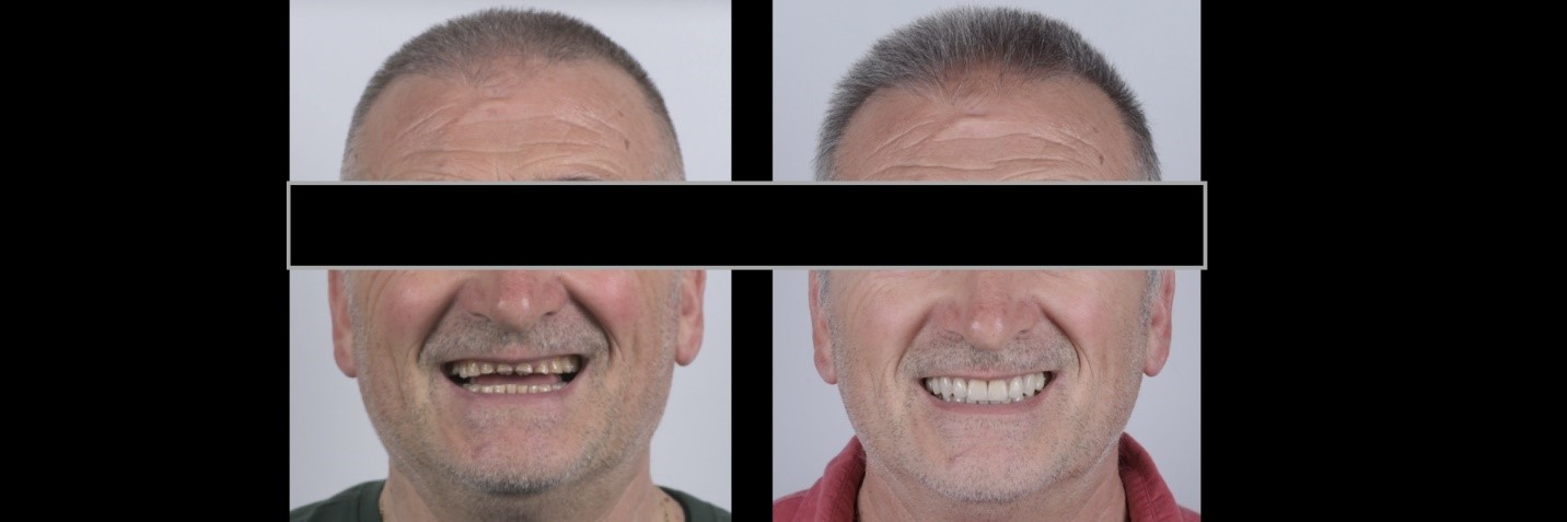 garrison-roberto-turrini