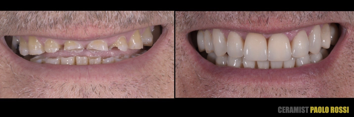 garrison-roberto-turrini