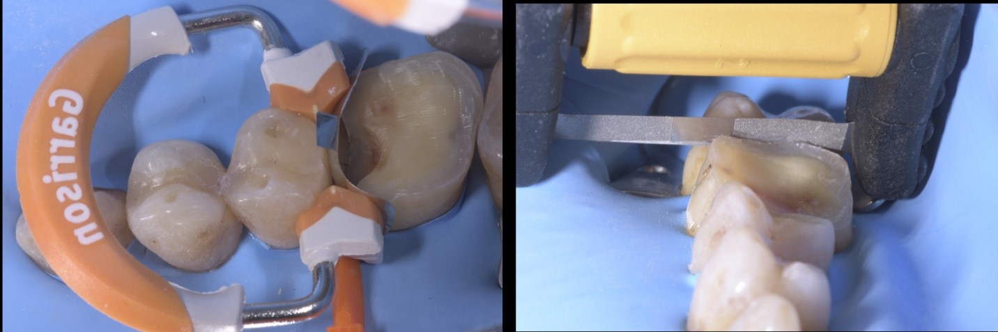 garrison-roberto-turrini