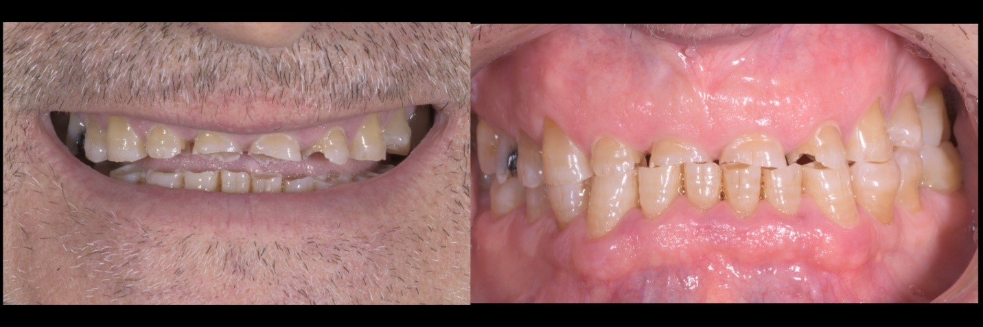 garrison-roberto-turrini