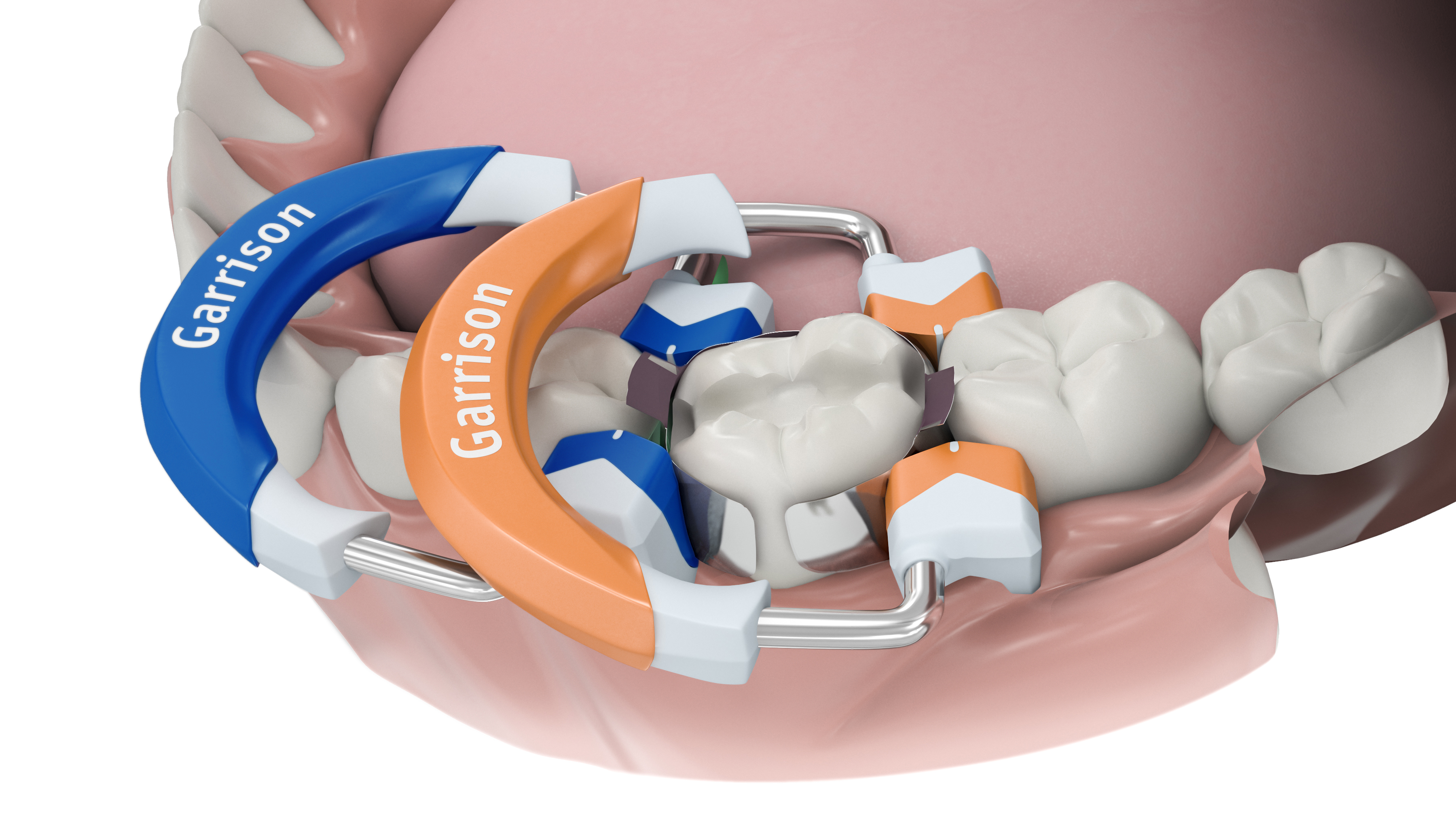 conservativa-matrice-garrison