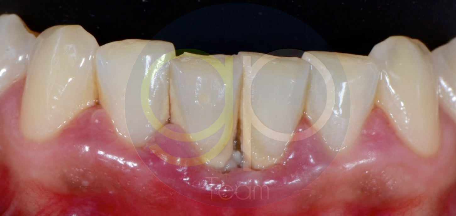 nsk-caso-varios-revello
