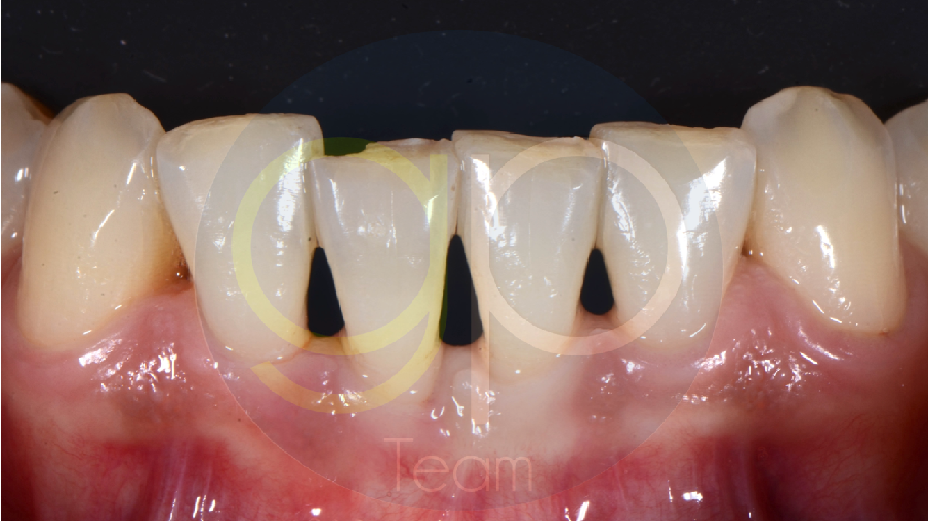 nsk-caso-varios-revello
